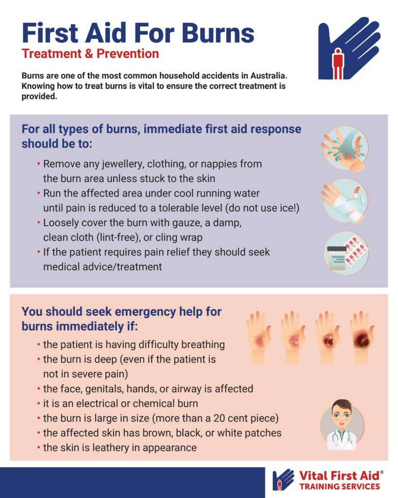 First Aid For Burns Infographic