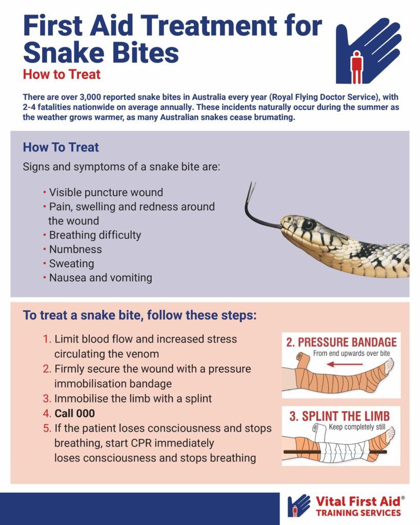 First Aid For Snake Bites Infographic