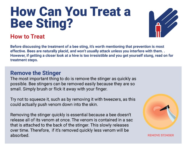Bee sting treatment guide